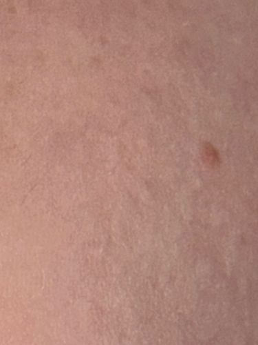 Not identifiable from image