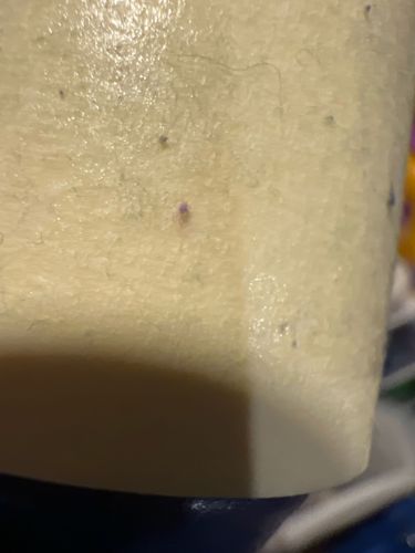 Bird mite / Rodent Mite