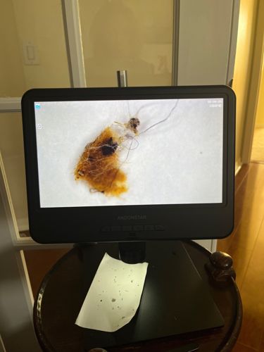 Carpet Beetle larvae or similar dermestid beetle larva