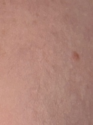 Not identifiable from image