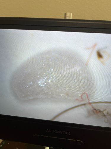 Aphid (possibly a shed skin or dead specimen)