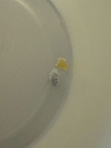 Carpet Beetle Larva (possibly Varied Carpet Beetle or Black Carpet Beetle)