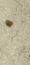 Dust mite