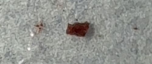 Whirligig Mite (or Anystid Mite)