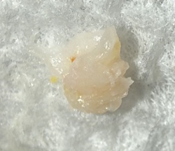 Mealybug
