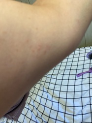 Bed Bug