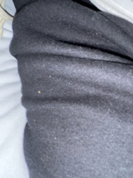 Carpet Beetle larvae (or similar dermestid beetle larvae)