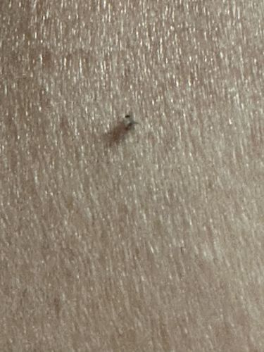 Gnat (likely Biting Midge or Sand Fly)