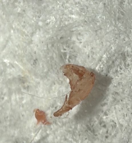 Cat Flea (fragments)