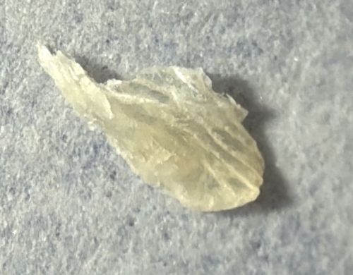 Not a bug (Debris or Organic Matter)