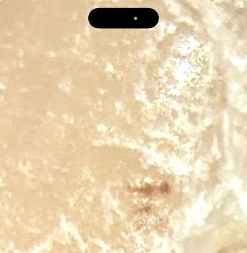 Not a bug (Appears to be a close-up of skin or a surface with phone UI overlay)