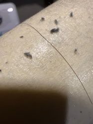 There is no identifiable insect or bug in the provided image. The image appears to show lint, dust, or other small debris on skin, along with a stray hair.