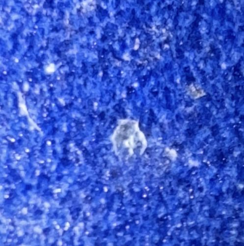 Pubic louse (Crab louse)