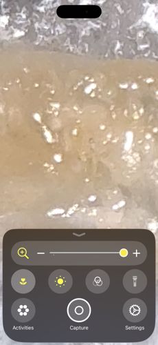 Louse (likely Head Louse)