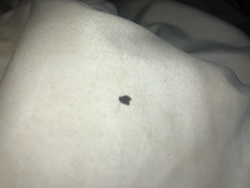 Unidentifiable insect/debris