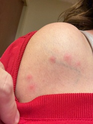Bed Bug