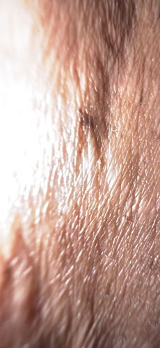 Unknown (Insufficient detail)
