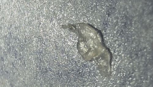 Demodex Mite (Face Mite)