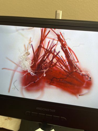 Midge larva (likely Chironomid)