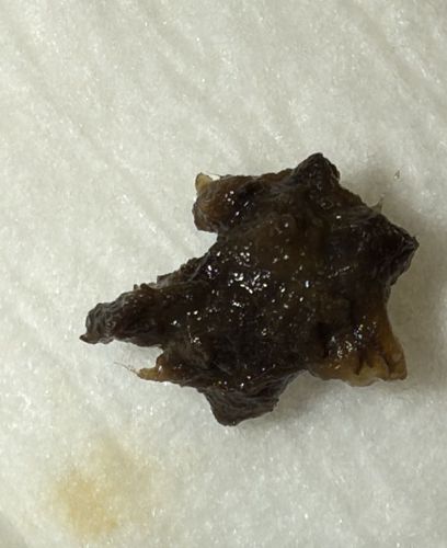 Undetermined (Non-insect material)