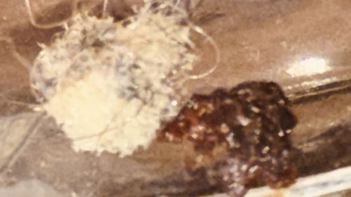 Unidentifiable insect remains/detritus