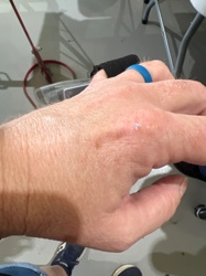 No identifiable insect/bug