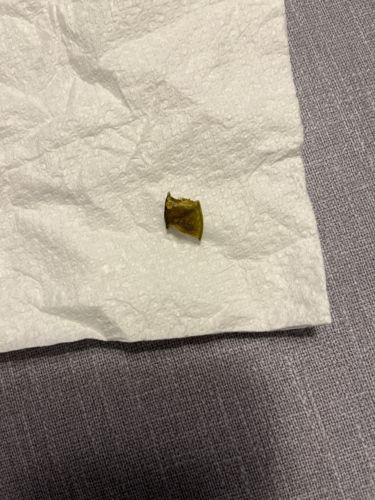 Unidentifiable Fragment (Likely Plant Matter)