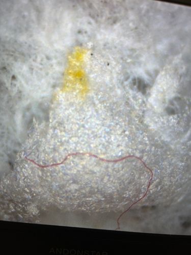 Not an insect or bug