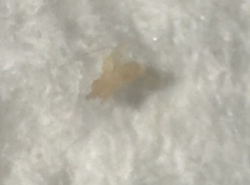 Skin Flake or Debris (Likely not a bug)