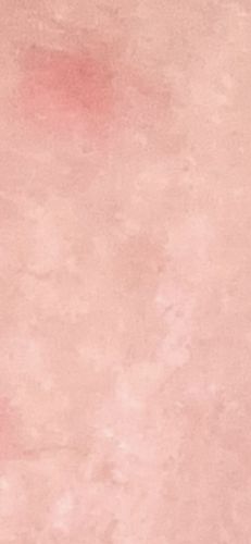 It is not possible to identify an insect from the provided image.