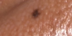 Tick