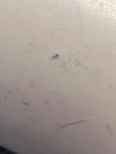 Dust Mite