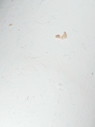 Unidentifiable organic debris