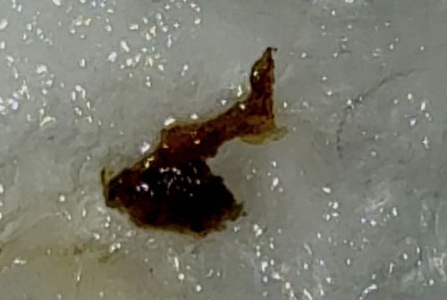 Likely Non-Insect Debris (Resembles Scab, Earwax, or Resin)