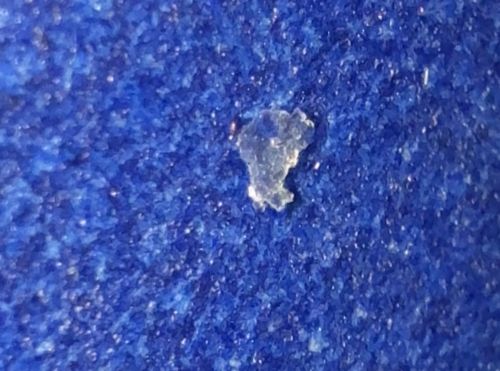 Not an Insect (Likely Skin Flake, Dandruff, or Debris)