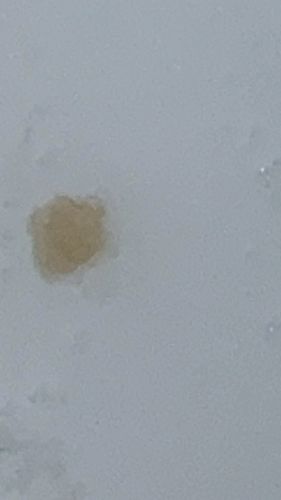 Common House Dust Mite
