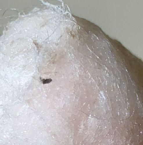 Louse (likely Head Louse)