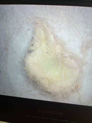 Carpet beetle larvae