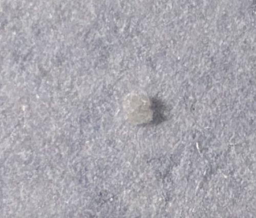 Body louse nit (egg)