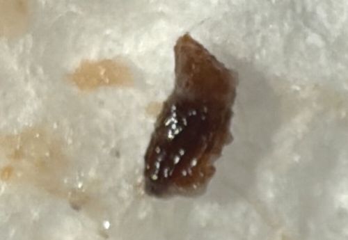 Earwax / Cerumen (Not a Bug)