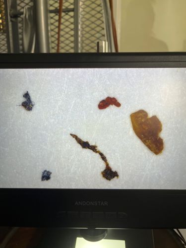 Not identifiable as an insect or bug