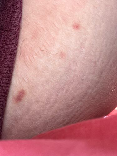 It is not possible to identify an insect from the provided image.