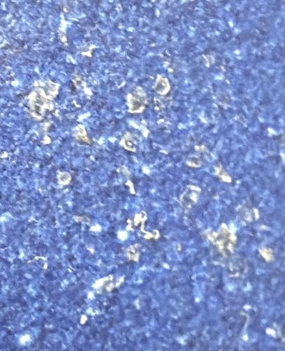 Non-Insect Debris (Likely Skin Flakes, Dandruff, or Lint)