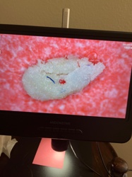 Not identifiable as an insect/bug