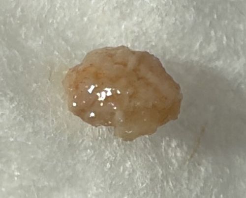 Common Bed Bug (Engorged Nymph/Egg Cluster Appearance)