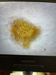 Lace Bug Nymph (or exuvia)