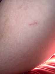 It is not possible to identify an insect or bug from the provided image. The image shows a small, red mark on what appears to be human skin, which could be anything from a scratch, a bite, a rash, or another skin irritation. Without a clear image of an insect, identification is not possible.