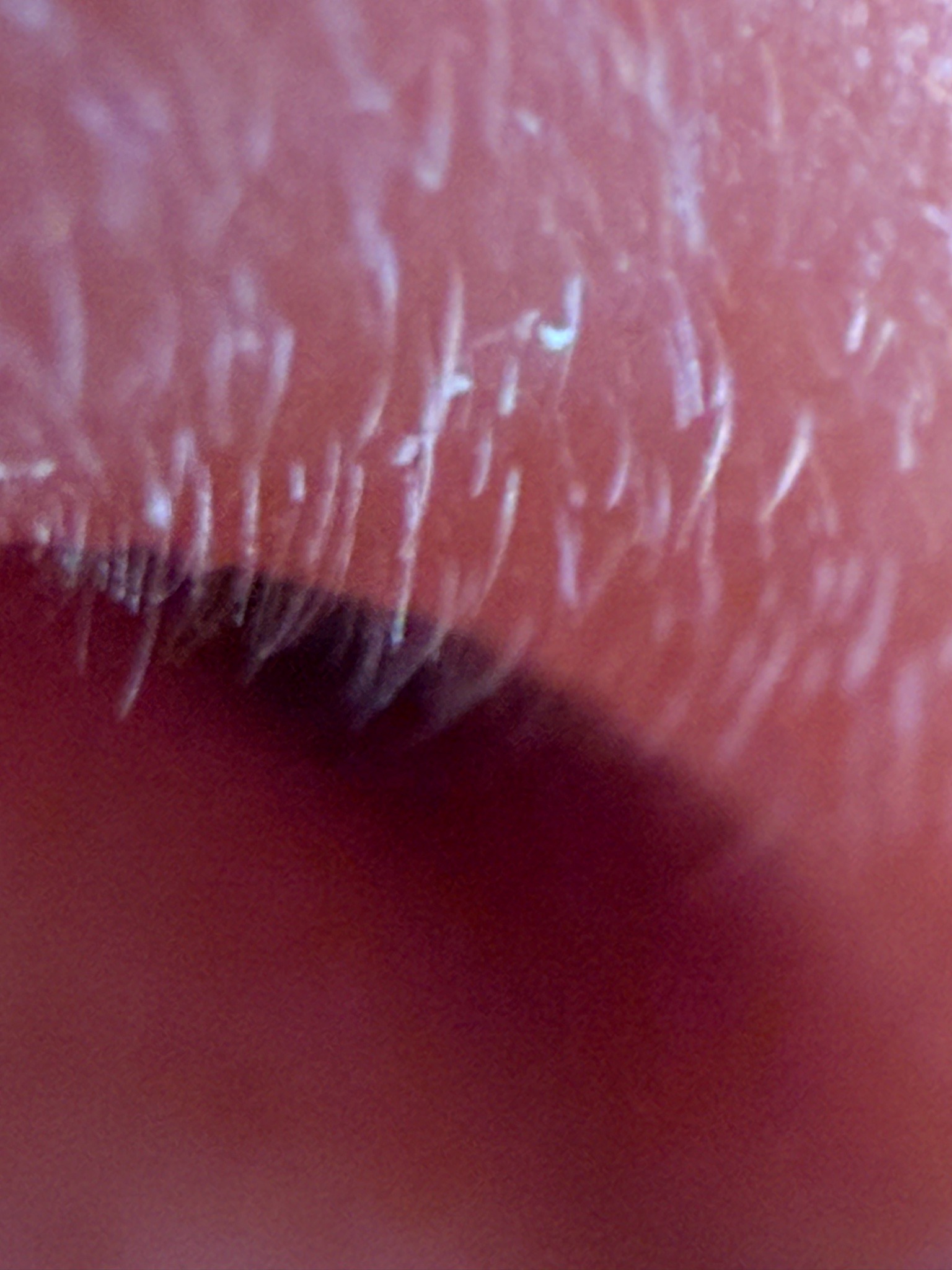 Face mite (or Eyelash mite)