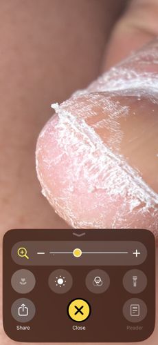 Itch mite