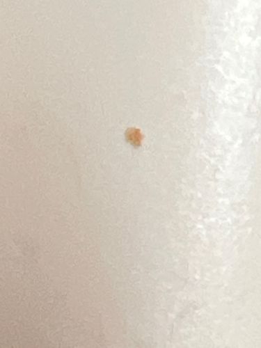 Unidentifiable due to image quality and scale